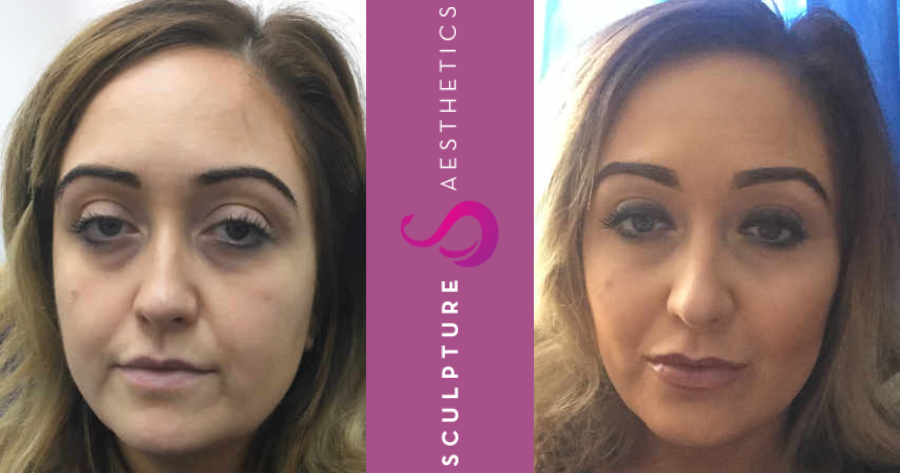 skin care treatments, dermal fillers & Botox in Gravesend, Kent.