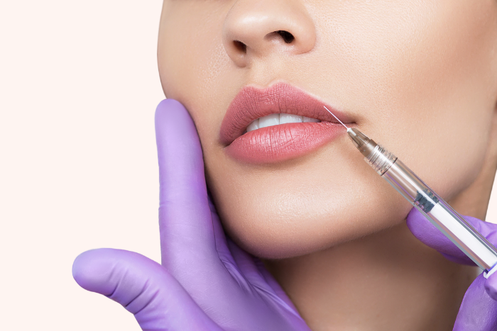 Lip Dermal Filler