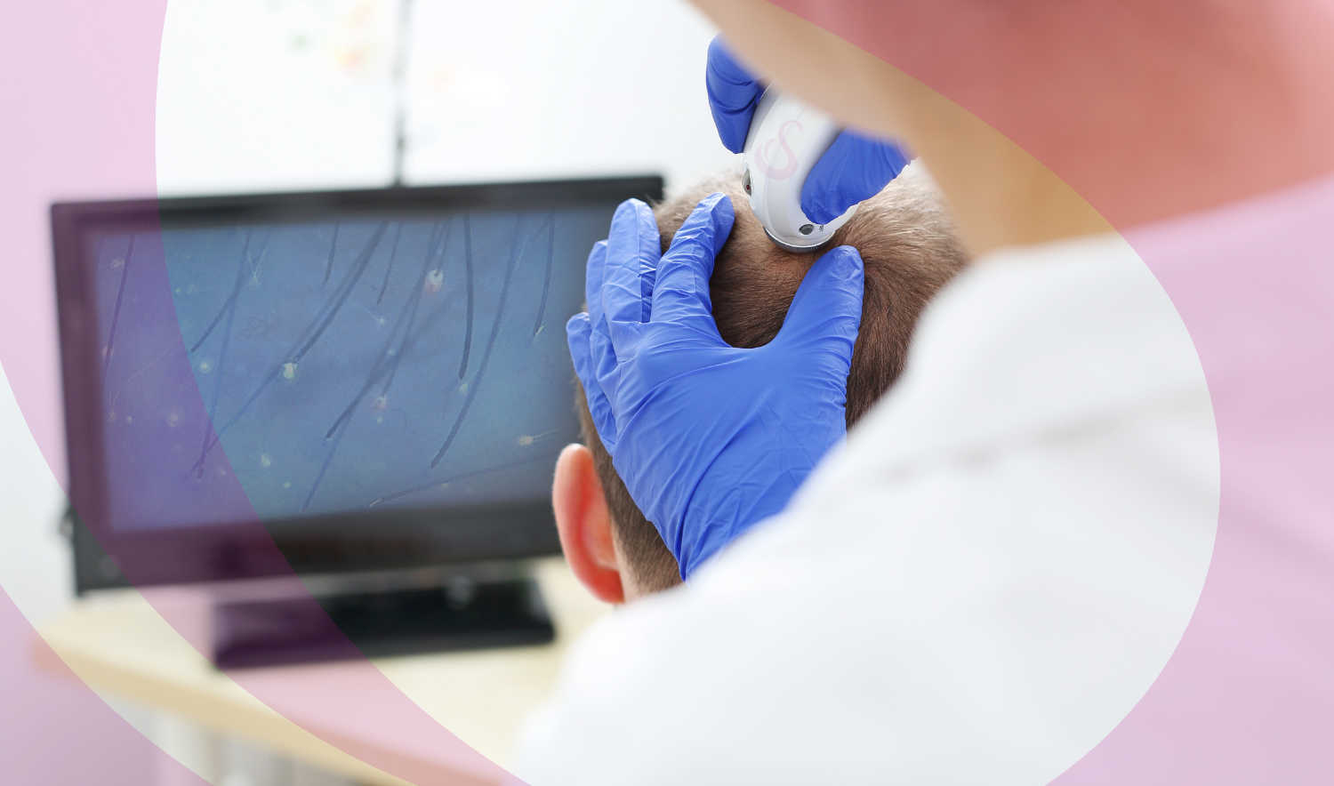 Banner HomePage Hair Restoration Meso Therapy