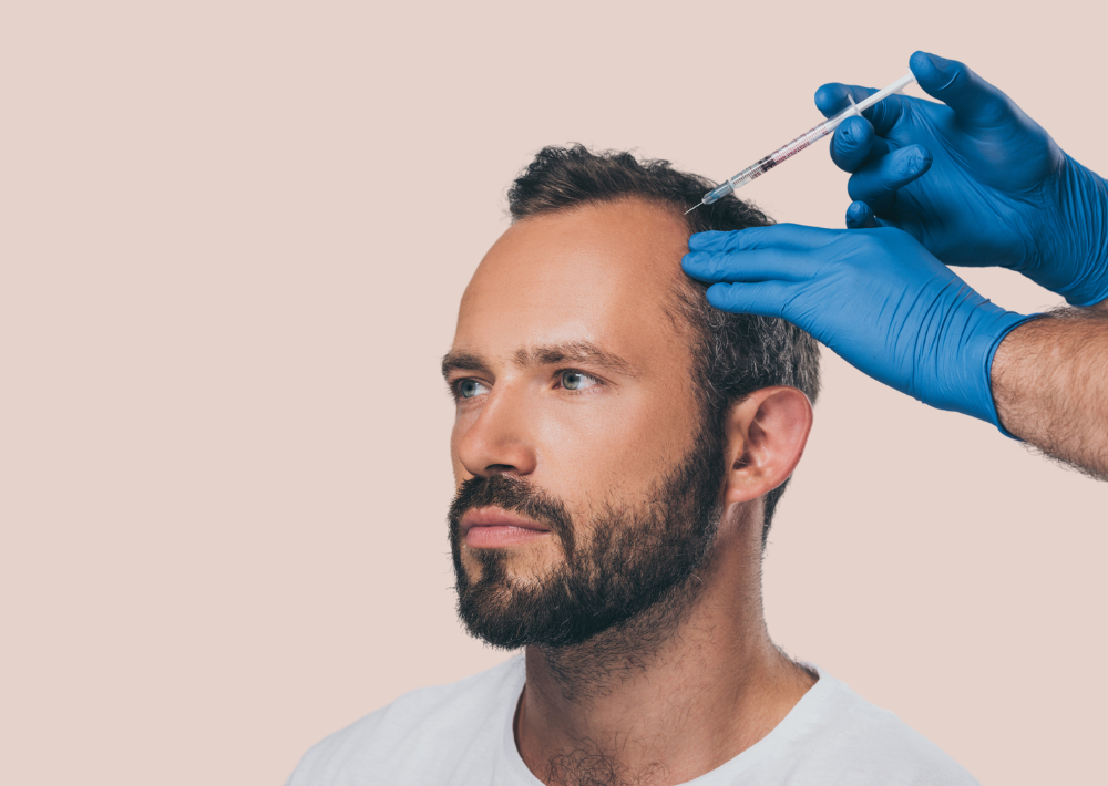 Hair Loss treatments in Gravesend Kent