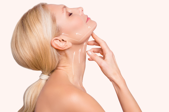 Nefertiti Neck Lift Treatment