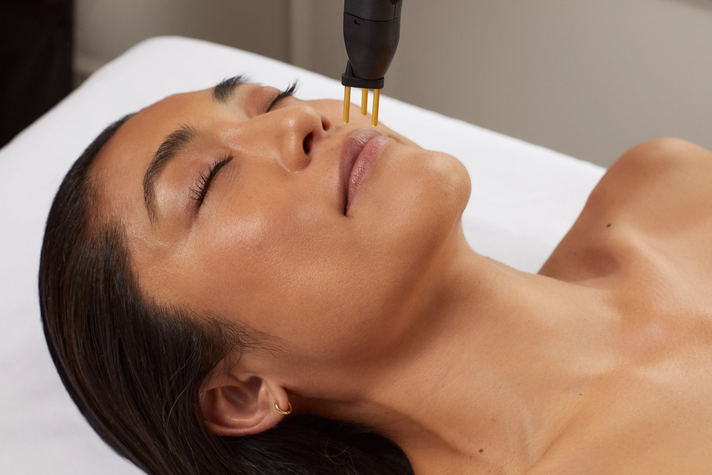 Neogen Plasma Treatment in Kent