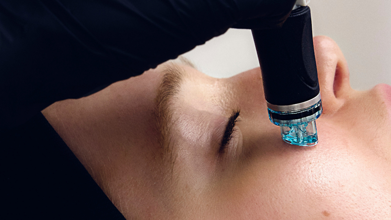 Hydrafacial treatment using the Vortex-Fusion handpiece at Sculpture Clinic.