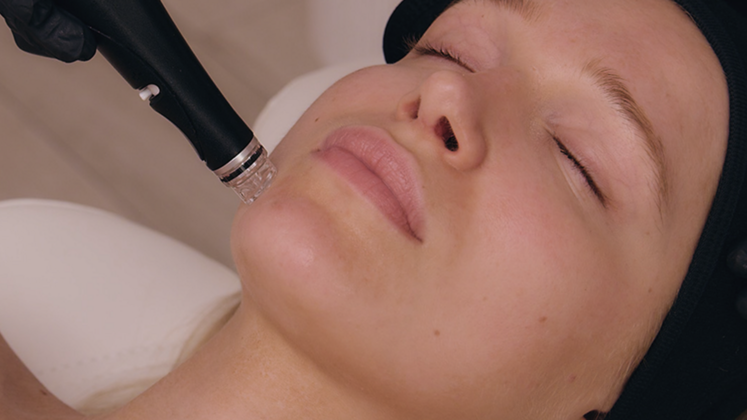 VISIA skin analysis used to personalise Hydrafacial boosters at Sculpture Clinic in Gravesend.