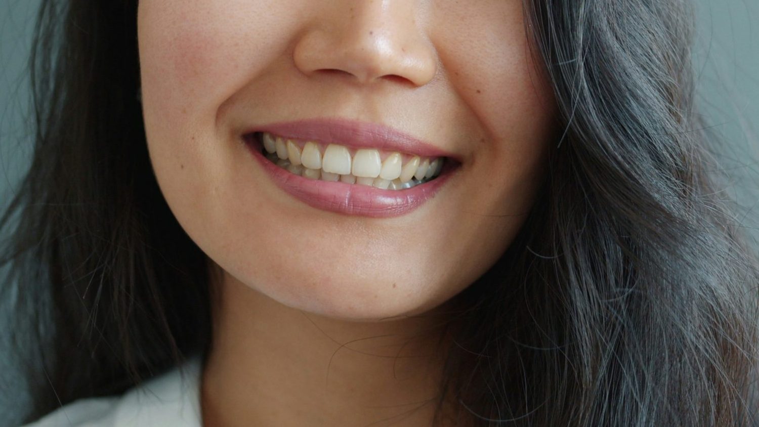 Facial anatomy photograph illustrating natural jaw width and lower-face proportions.
